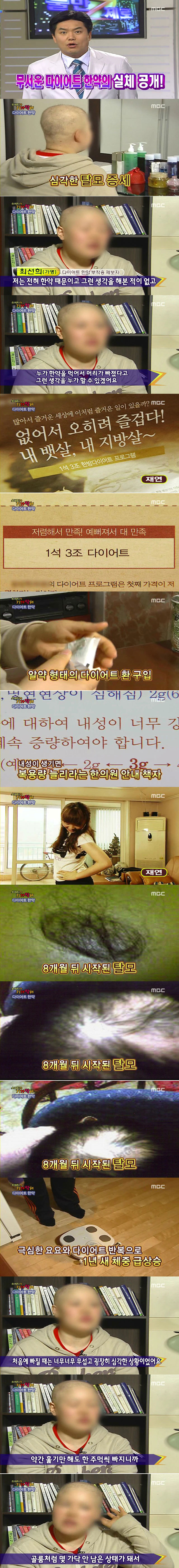 한약 다이어트 부작용 甲 | 인스티즈