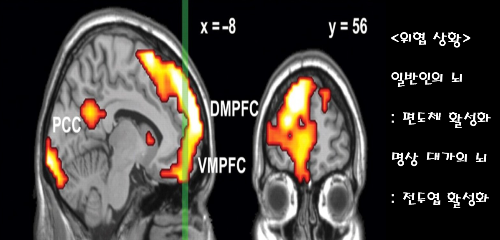 성인 ADHD를 자각하기 어려운 이유 | 인스티즈
