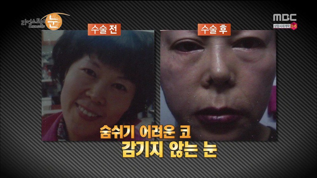 확인된 피해자만 50명이 넘는 싸이코 성형외과 의사 | 인스티즈