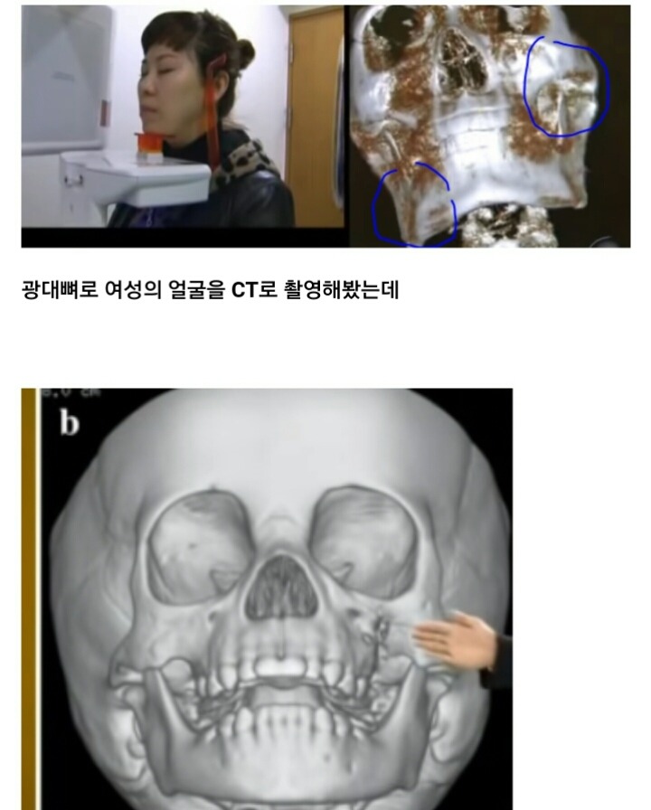 나이 먹으면 얼굴이 커지는 이유 | 인스티즈