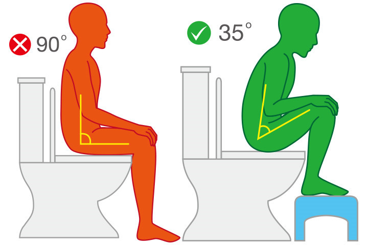 무슨 그런 것때문에 허리디스크가 생겨? 싶은것들 | 인스티즈