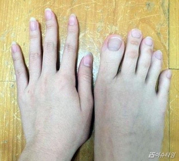손가락처럼 발가락이 긴 사람.jpg (긴발사진있음) | 인스티즈