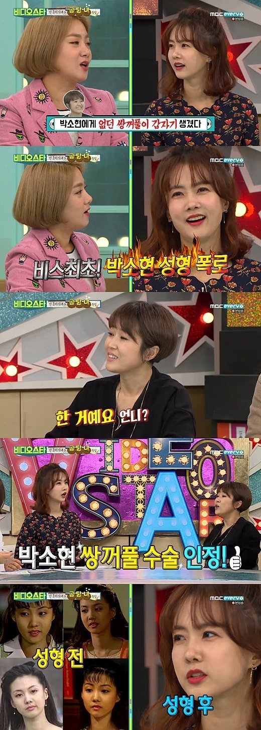 박소현 성형 최초공개.jpg | 인스티즈