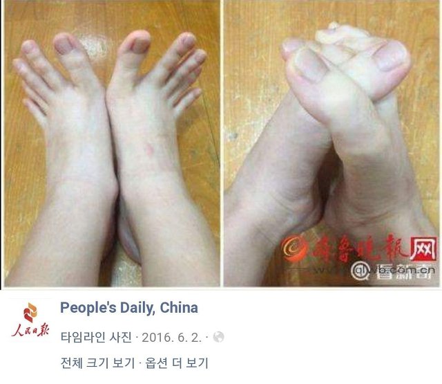 손가락처럼 발가락이 긴 사람.jpg (긴발사진있음) | 인스티즈