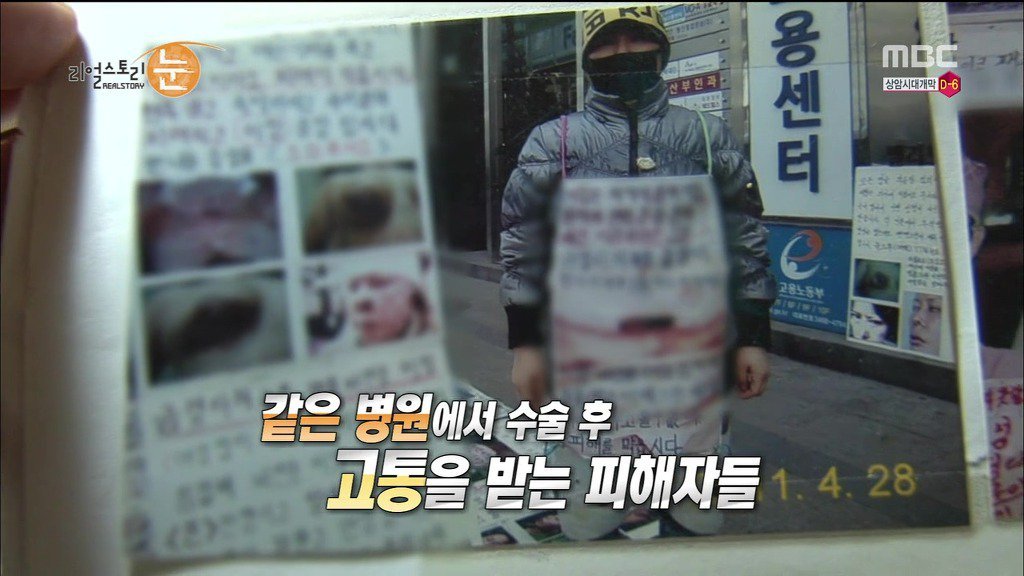 확인된 피해자만 50명이 넘는 싸이코 성형외과 의사 | 인스티즈