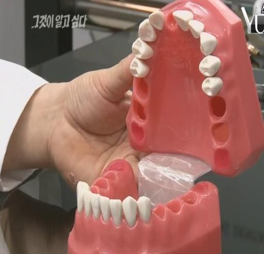 이쯤에서 다시 보는 MC몽 치아 상태.jpg | 인스티즈