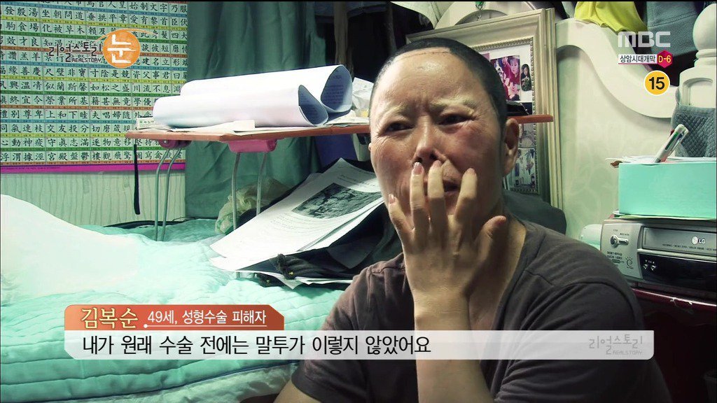 확인된 피해자만 50명이 넘는 싸이코 성형외과 의사 | 인스티즈