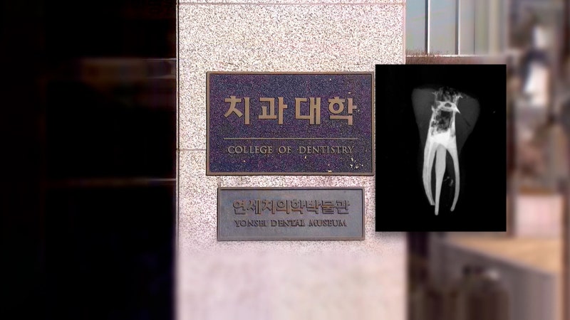 사고 친 치대생들, 그리고 또 헬조선 엔딩 | 인스티즈