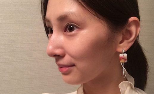 한국이랑은 많이 다른 일본의 성형 트렌드(눈과 코).jpg | 인스티즈