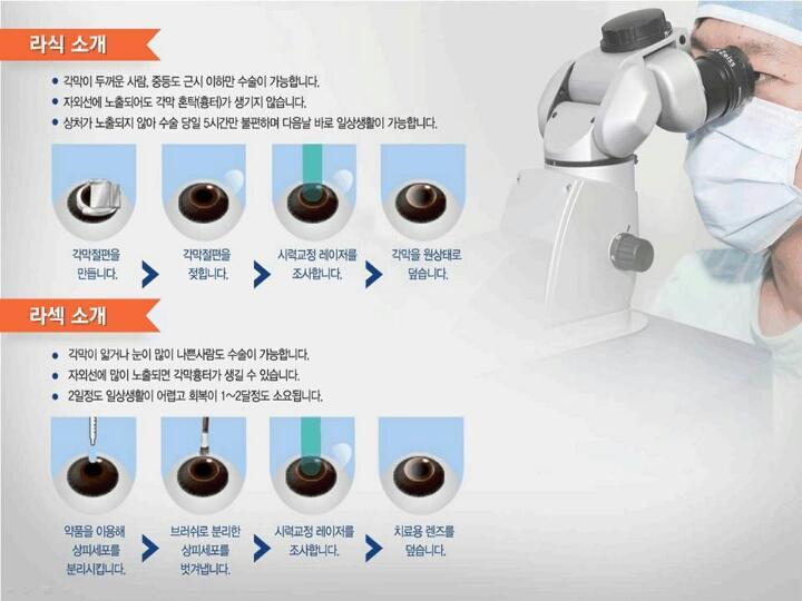 라식수술과 라섹수술의 차이점 | 인스티즈