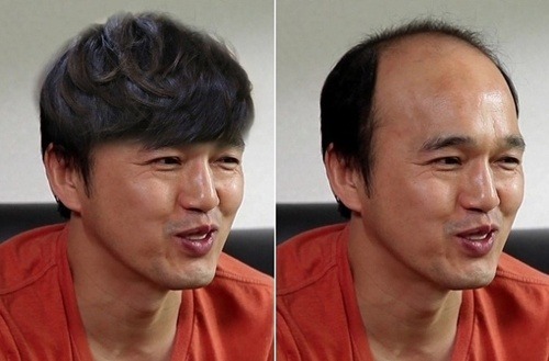 김광규 가발합성 | 인스티즈