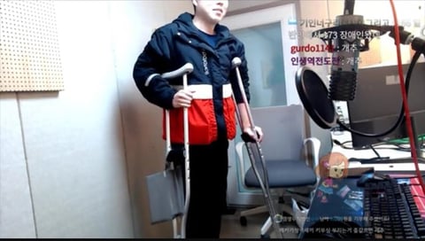 "167→173cm"…스트리머 렐라, 키 수술 후기 공개 | 인스티즈