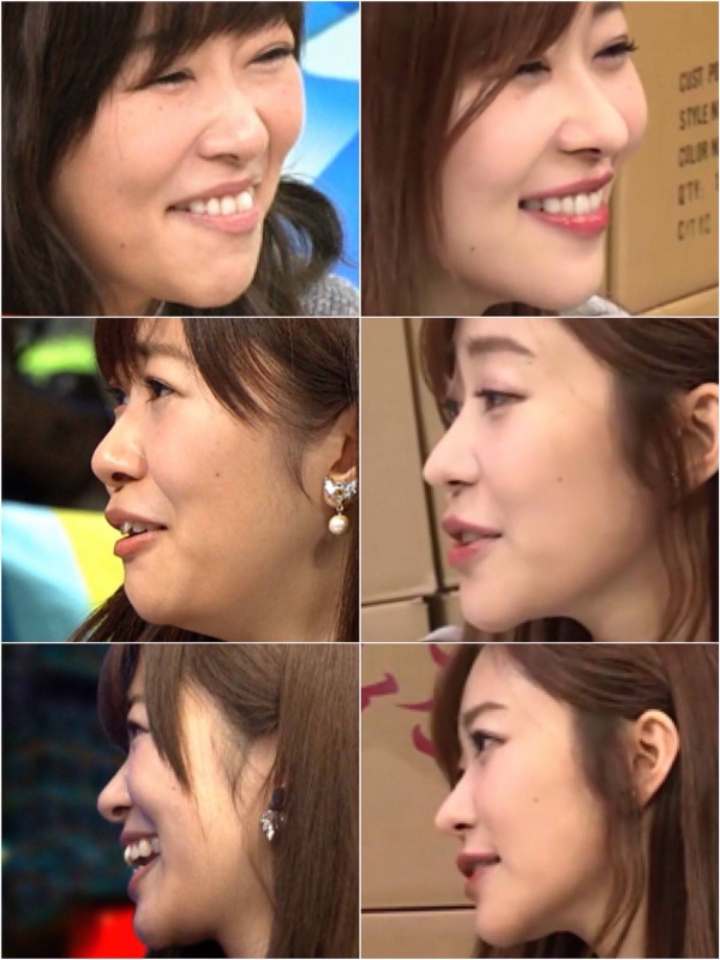 한국이랑은 많이 다른 일본의 성형 트렌드(눈과 코).jpg | 인스티즈