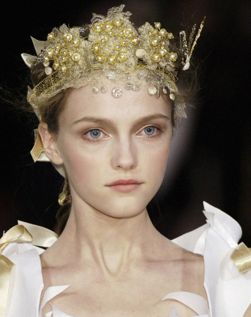 너무 말라서 거식증 논란이 있었던 모델들 | 인스티즈