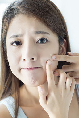 여드름 개선방안 피부 좋아지고 싶다면 클릭 | 인스티즈