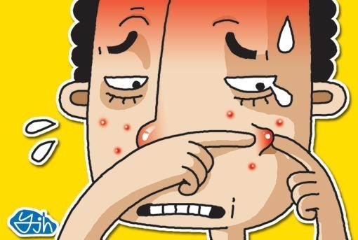 여드름 개선방안 피부 좋아지고 싶다면 클릭 | 인스티즈