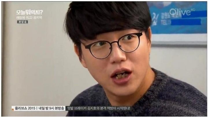 성시경 치열.JPG | 인스티즈
