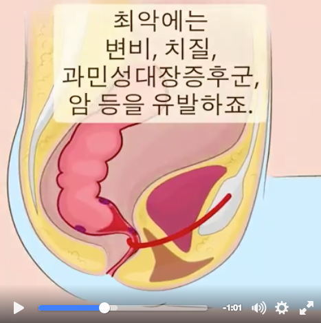 여태껏 여러분은 잘못된 자세로 양변기를 쓰셨습니다 (쾌변을 위한 최고의 꿀팁) | 인스티즈