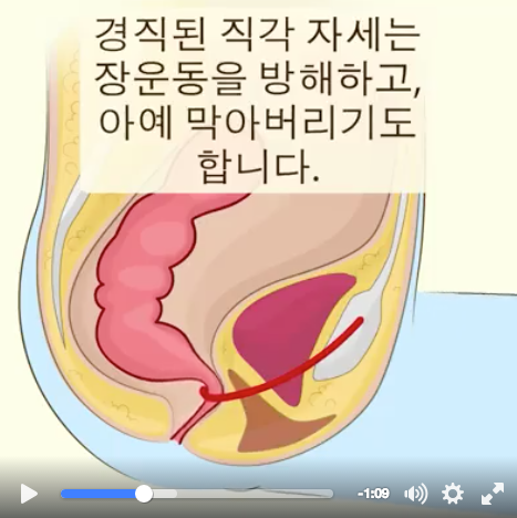 여태껏 여러분은 잘못된 자세로 양변기를 쓰셨습니다 (쾌변을 위한 최고의 꿀팁) | 인스티즈