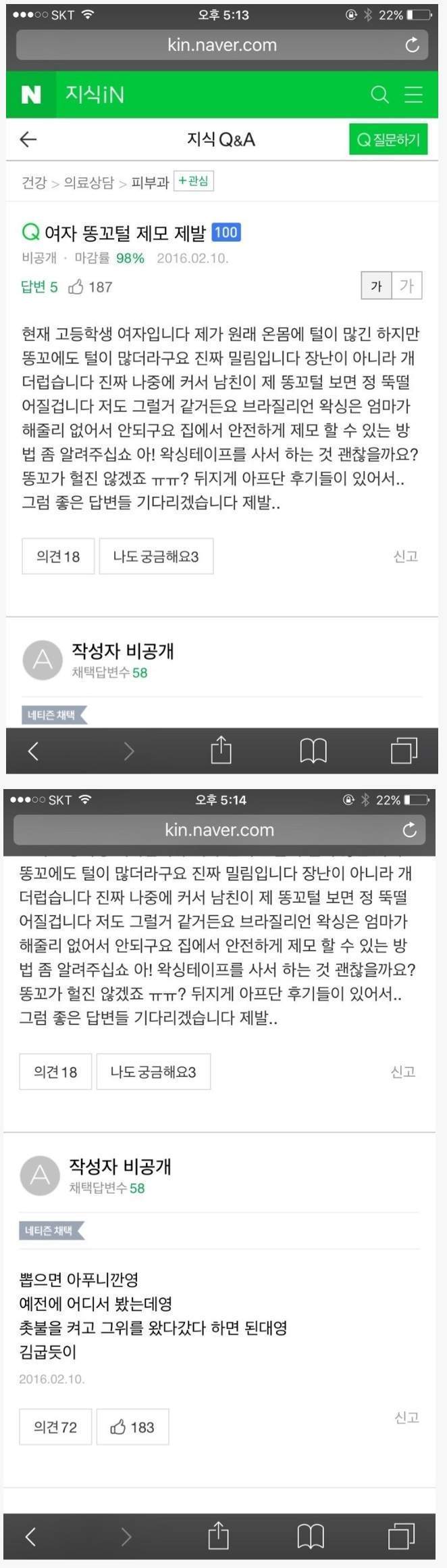 여고생 똥꼬털 왁싱하는 법.jpg | 인스티즈