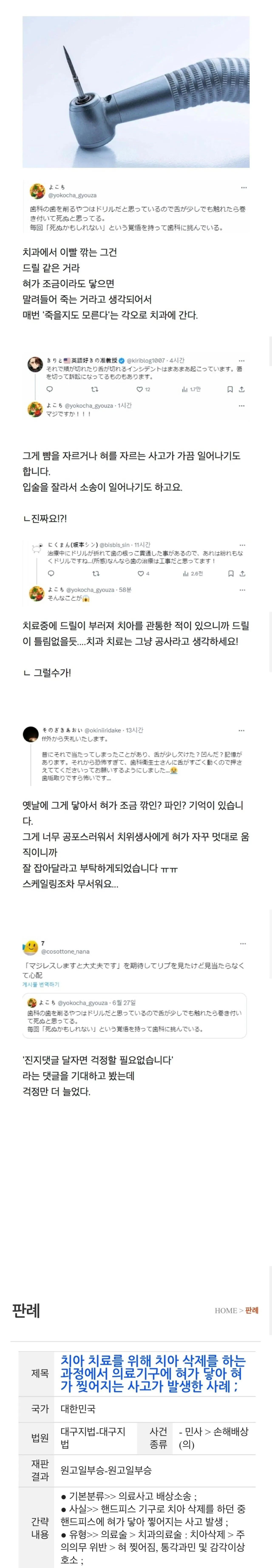 치과 드릴이 혀에 닿을까봐 무섭다는 사람들 | 인스티즈