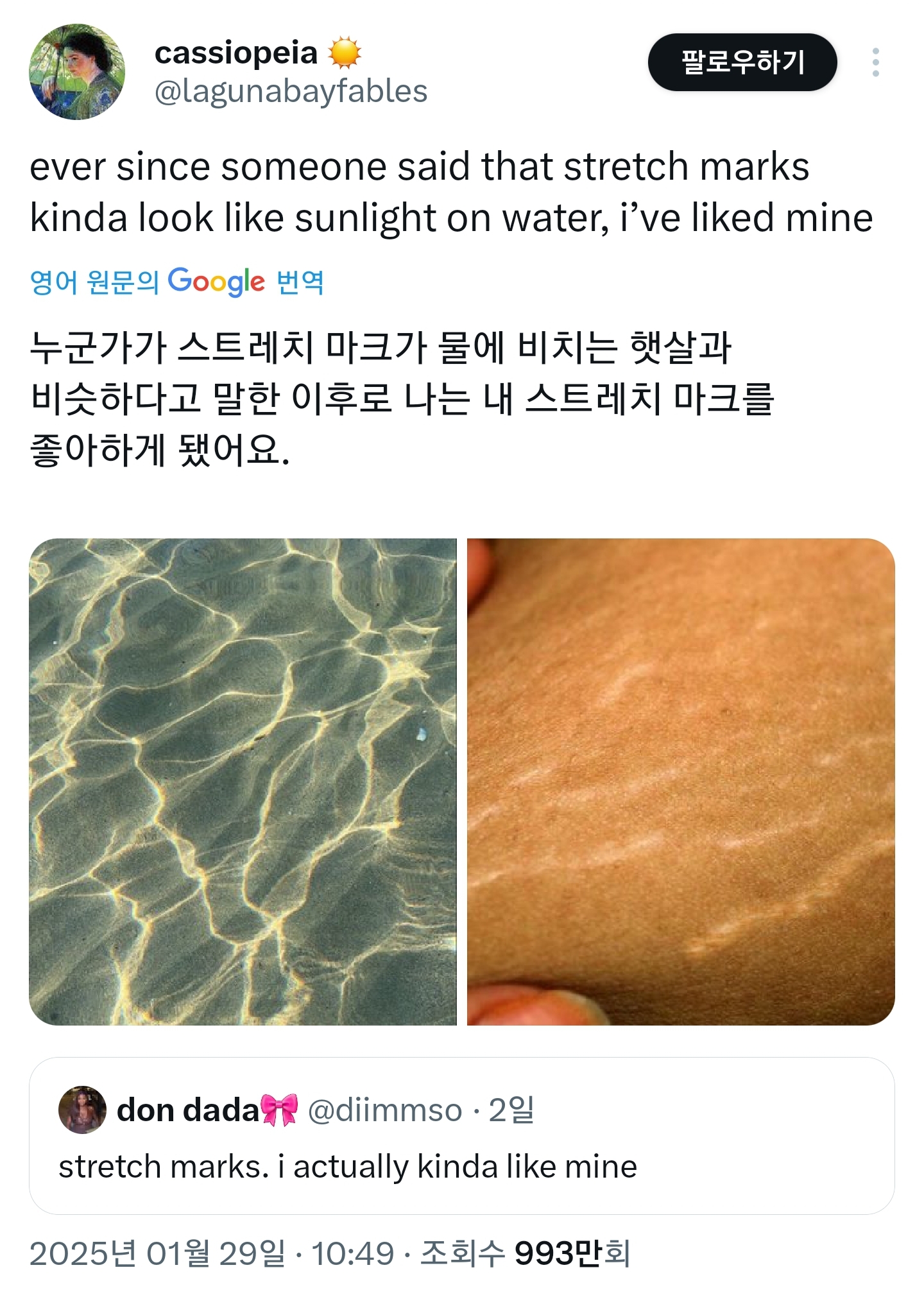 누군가 내 튼살을 물에 비친 햇살과 같다고 말한 이후로 나는 내 튼살을 좋아하게 됐어요 | 인스티즈