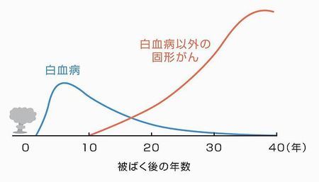 스압) 방사능을 걱정하며 살고 있습니까? -일본인들의 대답 | 인스티즈