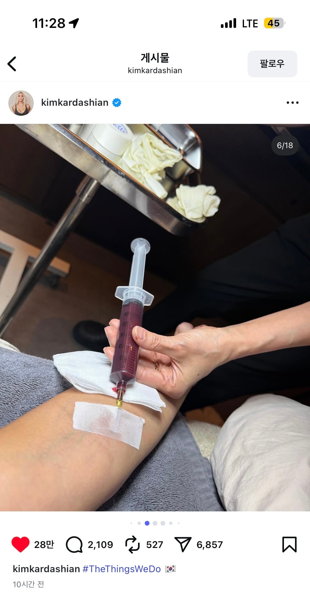 한국 피부과 시술 인증샷 올린 킴 카다시안 | 인스티즈
