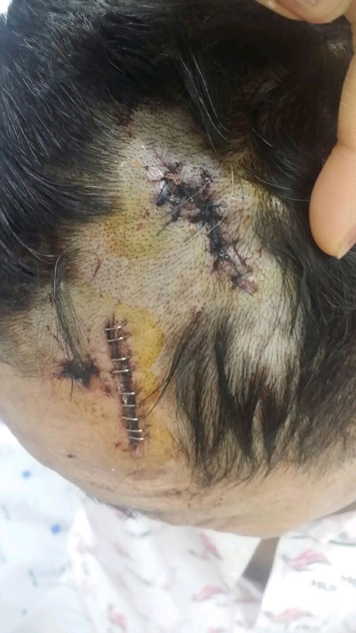 부모님이 살인청부를 당하셨습니다 (혐오주의) | 인스티즈