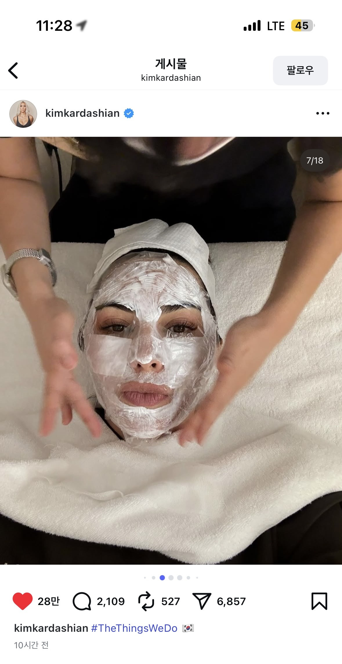한국 피부과 시술 인증샷 올린 킴 카다시안 | 인스티즈