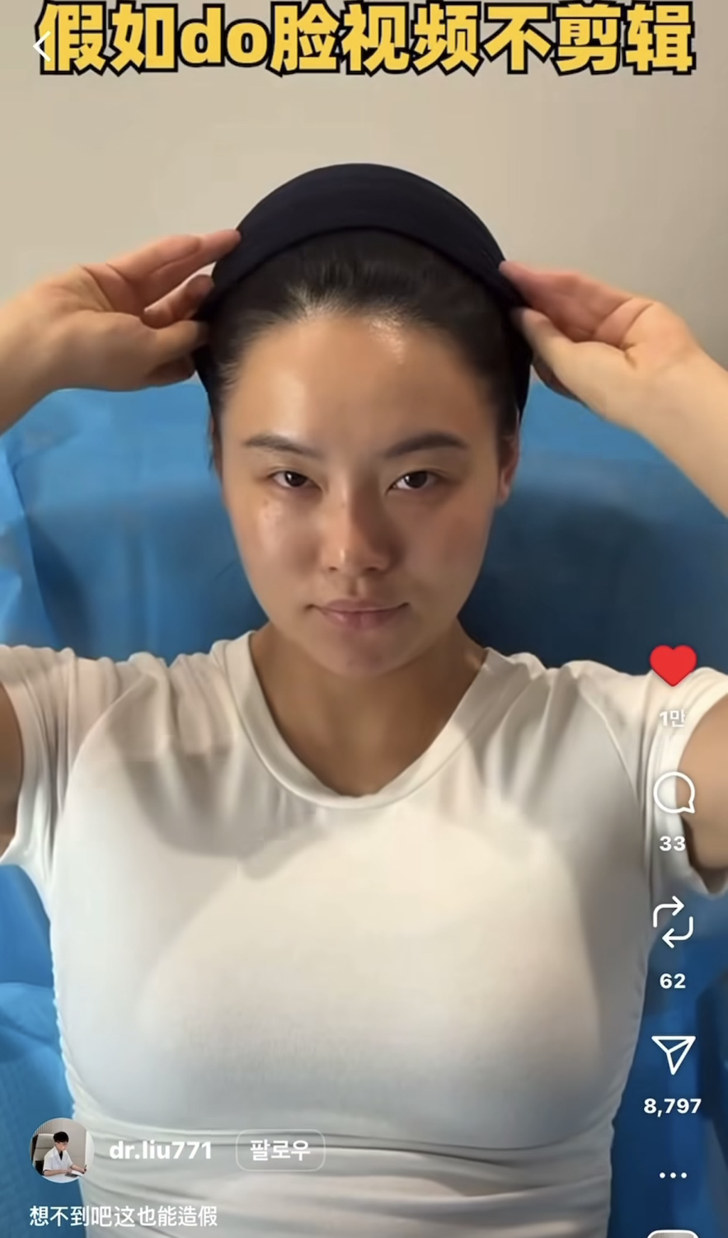 성형•시술 가짜 비포 애프터 만드는 과정.jpg | 인스티즈