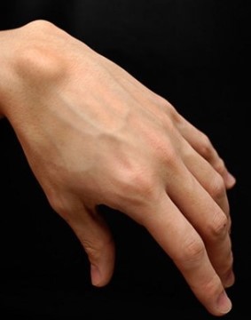 피뽑기 정맥채혈 팔안쪽 vs 손등 어느걸 더 선호하시나요? | 인스티즈