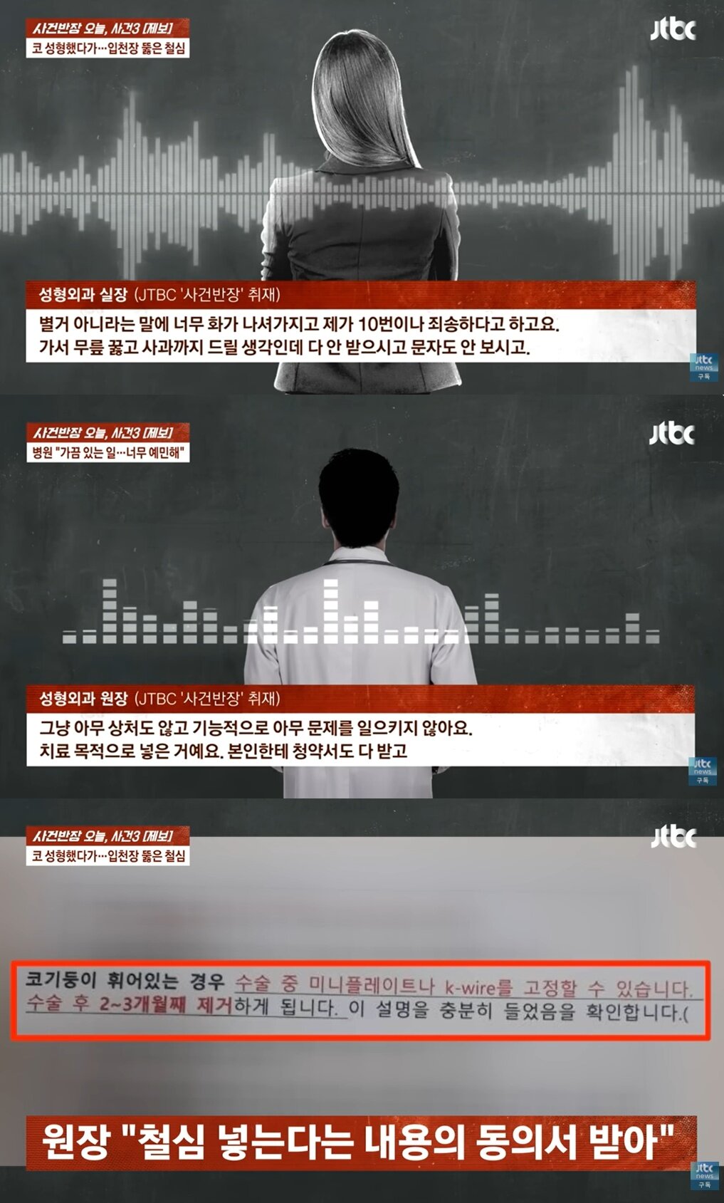 코에 박은 철심이 입천장 뚫고 나왔는데…병원 "제거하면 그만" | 인스티즈