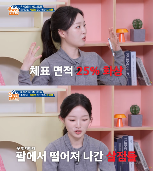 '아기맹수' 김시현 셰프, 체표면적 25% 화상 사고 "옷 벗으니 살점 떨어져" | 인스티즈