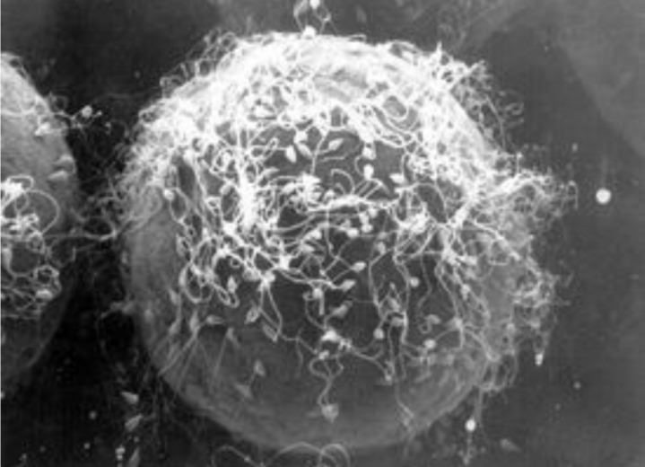 질내사정 전후 난자의 모습 | 인스티즈