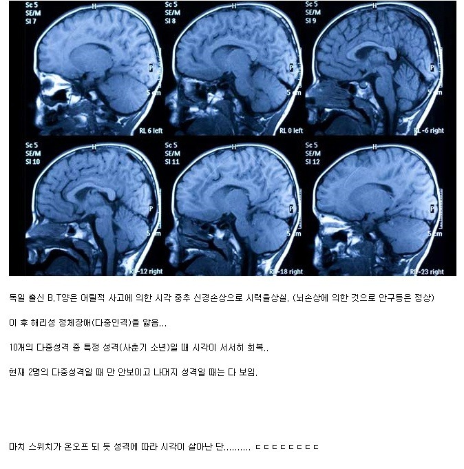 인간 뇌의 미스테리 중 최고의 미스테리 | 인스티즈