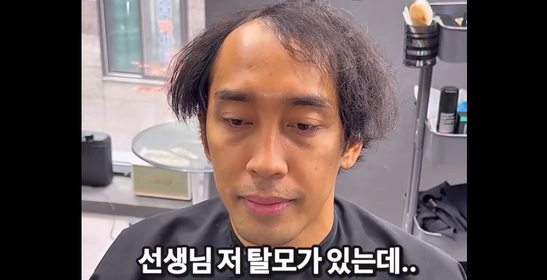 탈모가 있는데 헤어 가능할까요 | 인스티즈