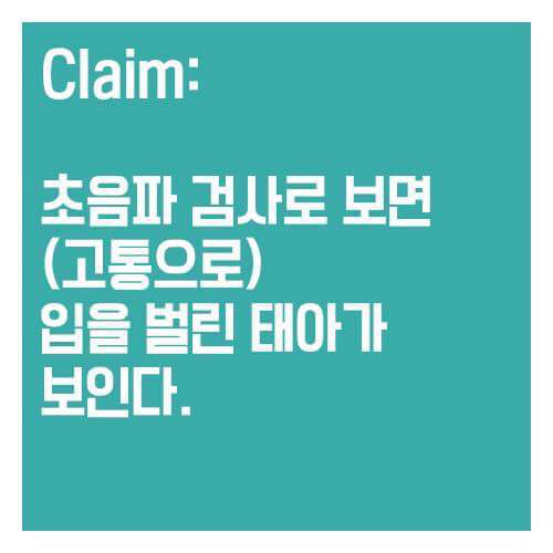 어릴적부터 여자들에게 세뇌시키듯 보여준 낙태비디오의 진실 | 인스티즈