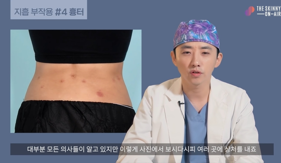 비만클리닉 의사가 지흡을 반대하는 이유.jpg | 인스티즈