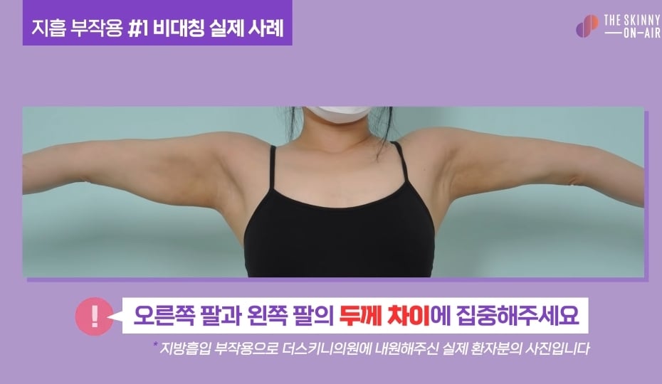 비만클리닉 의사가 지흡을 반대하는 이유.jpg | 인스티즈