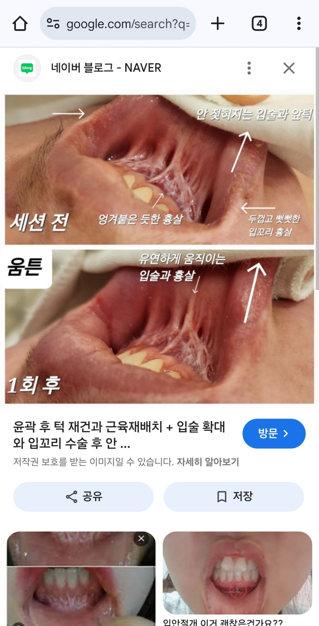 윤곽흉살 (혐주의 | 인스티즈