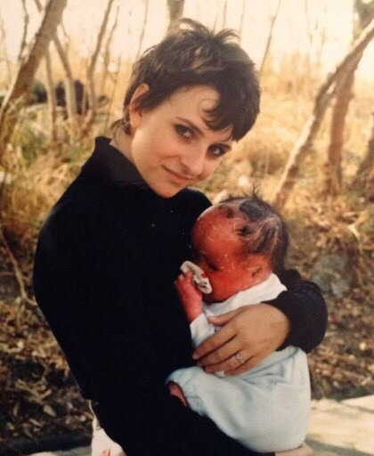 '할리퀸 어린선'을 가지고 태어난 아기..(사진주의!정말 놀랄수있어요) | 인스티즈