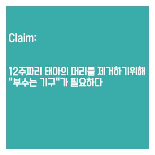 어릴적부터 여자들에게 세뇌시키듯 보여준 낙태비디오의 진실 | 인스티즈