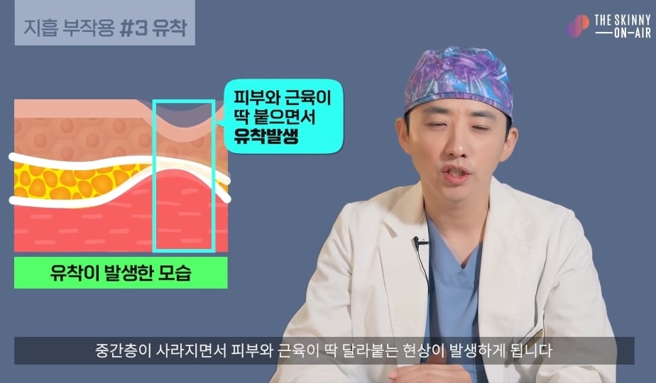 비만클리닉 의사가 지흡을 반대하는 이유.jpg | 인스티즈