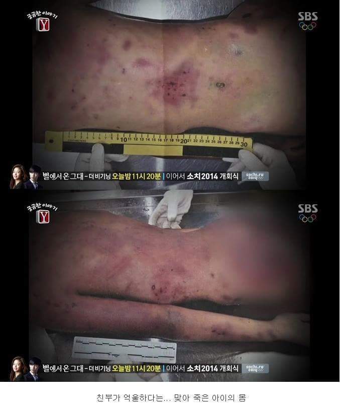 27시간동안 친부와 새엄마에게 맞아죽은 9살건희.. | 인스티즈