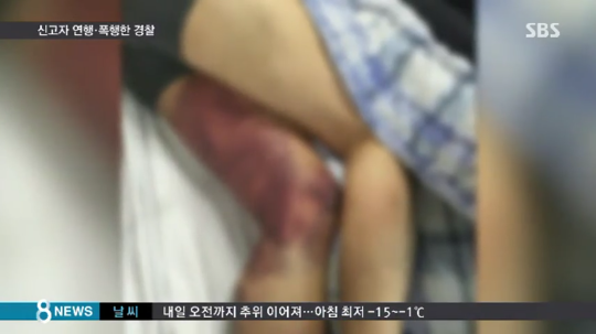 경찰이 신고한 시민을 폭행한 이유는?? | 인스티즈