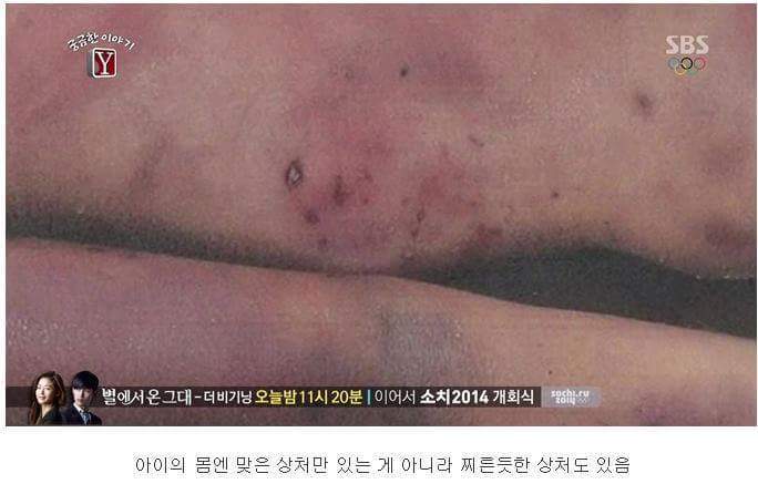 27시간동안 친부와 새엄마에게 맞아죽은 9살건희.. | 인스티즈