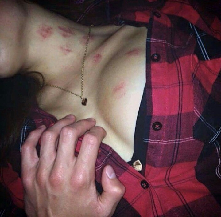 솔로들은 모르는 피부병 | 인스티즈