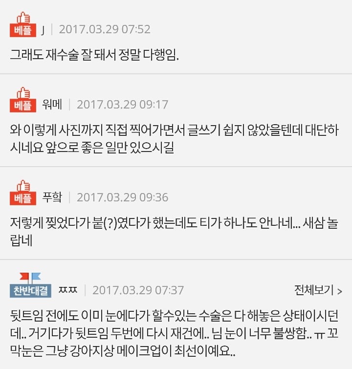 눈꼬리내리기뒤트임하고 인생 제대로 망할 뻔 했습니다.*혐오주의 | 인스티즈