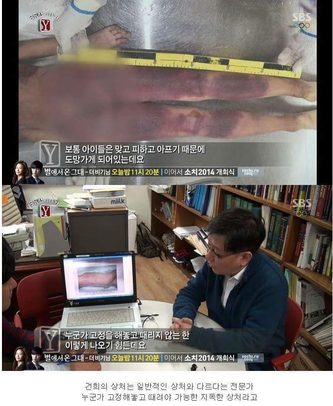 27시간동안 친부와 새엄마에게 맞아죽은 9살건희.. | 인스티즈